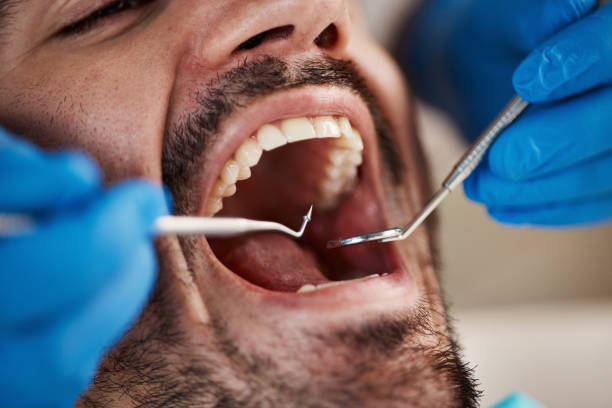Emergency Dental Services in Berry Creek, CA