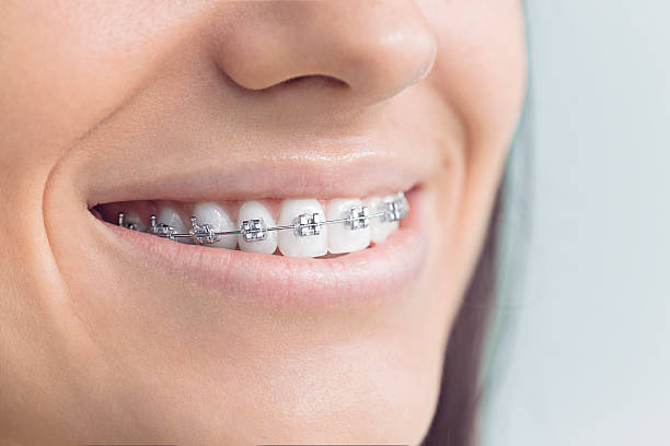 Best Oral Cancer Screening  in Berry Creek, CA